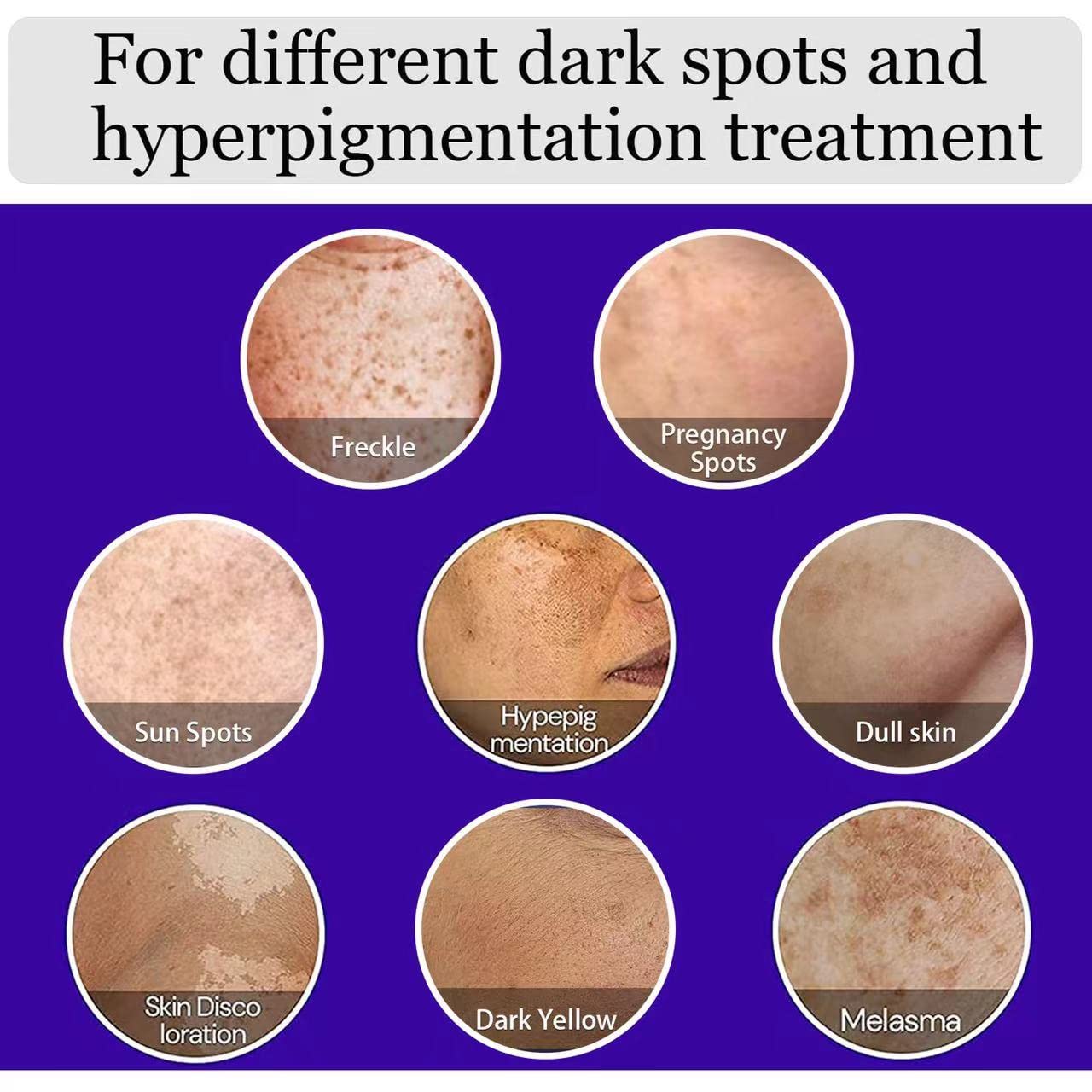 Dark Spot Corrector